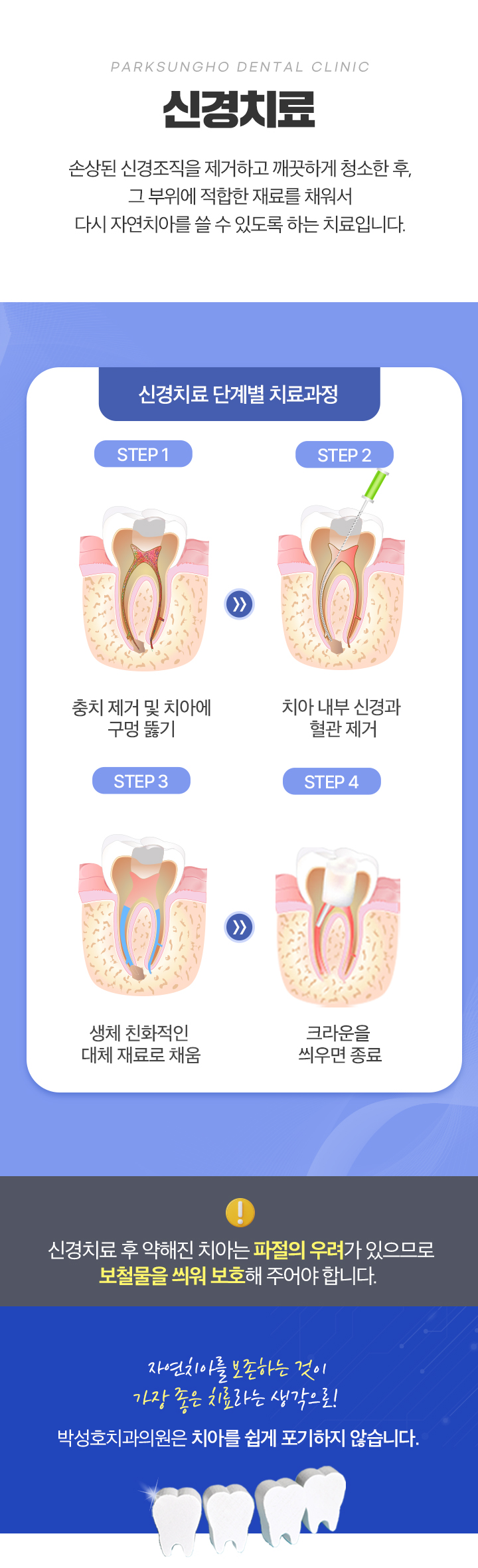 신경치료